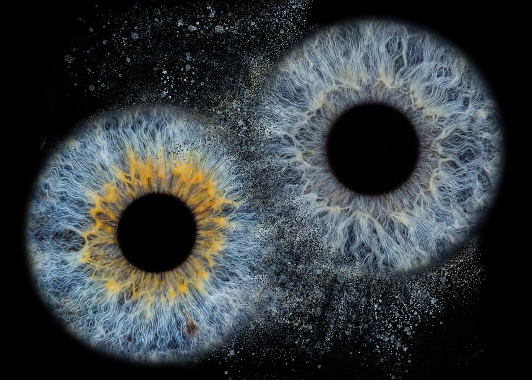 Irisfotografie Paxis Optiker & Augenärzte Hochzeitsfotograf Bochum